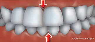 top rated orthodontics hoppers crossing 