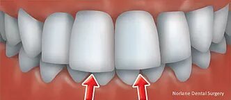 orthodontics treatment