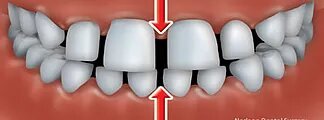 affordable orthodontics treatment hoppers crossing