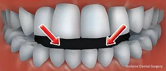 top rated orthodontics treatment hoppers crossing