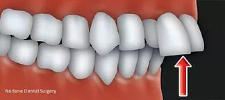 best orthodontics treatment