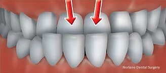 orthodontics in hoppers crossing