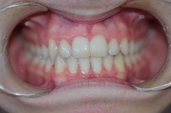 Top Orthodontics in Hoppers Crossing