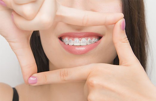 braces cleaning tips hoppers crossing